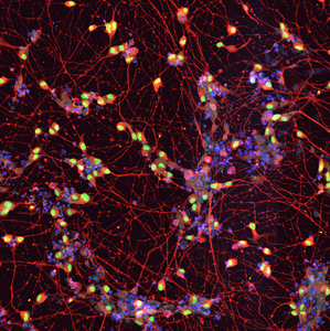 iPSCs-derived Motor neurons derived from an ALS patient