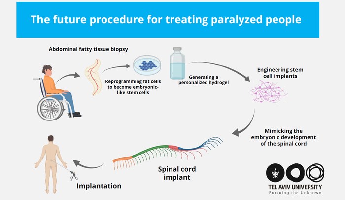 Visualization of the next stage of the research - human spinal cord implants for treating paralysis