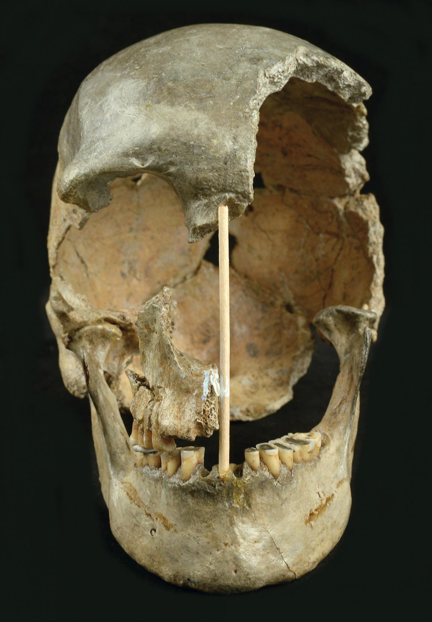 Skull frontal view