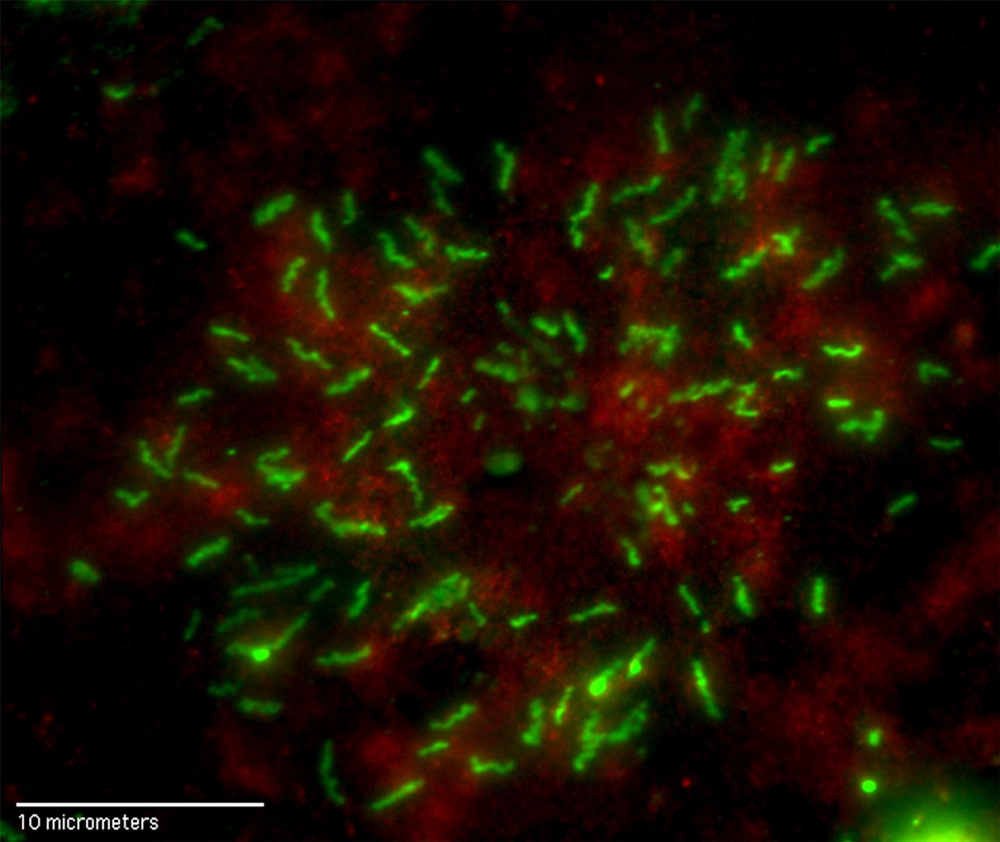Antibodies Bound to Clotting Factor VIII