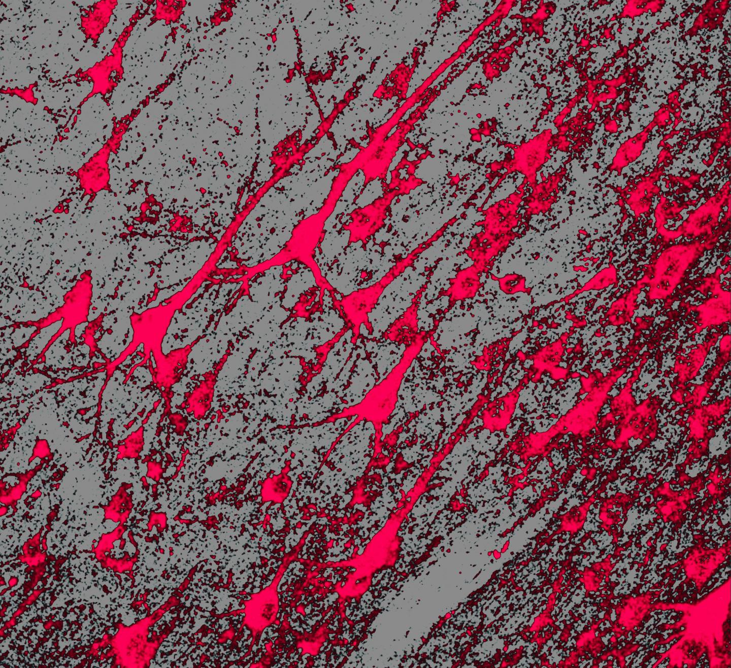 One-and-Done Gene Therapy