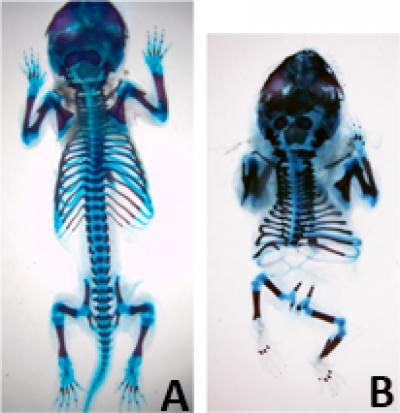The Gene Isl1 Acts as a Stop Signal to the Axial Progenitors