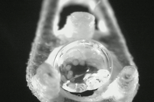 Cryopreserved pancreatic islet cells