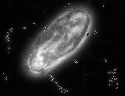 Bacterial Particles Linked to Inflammatory Bowel Disease