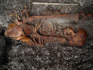 Syphilis-like diseases were already widesprea - Vimarsana News