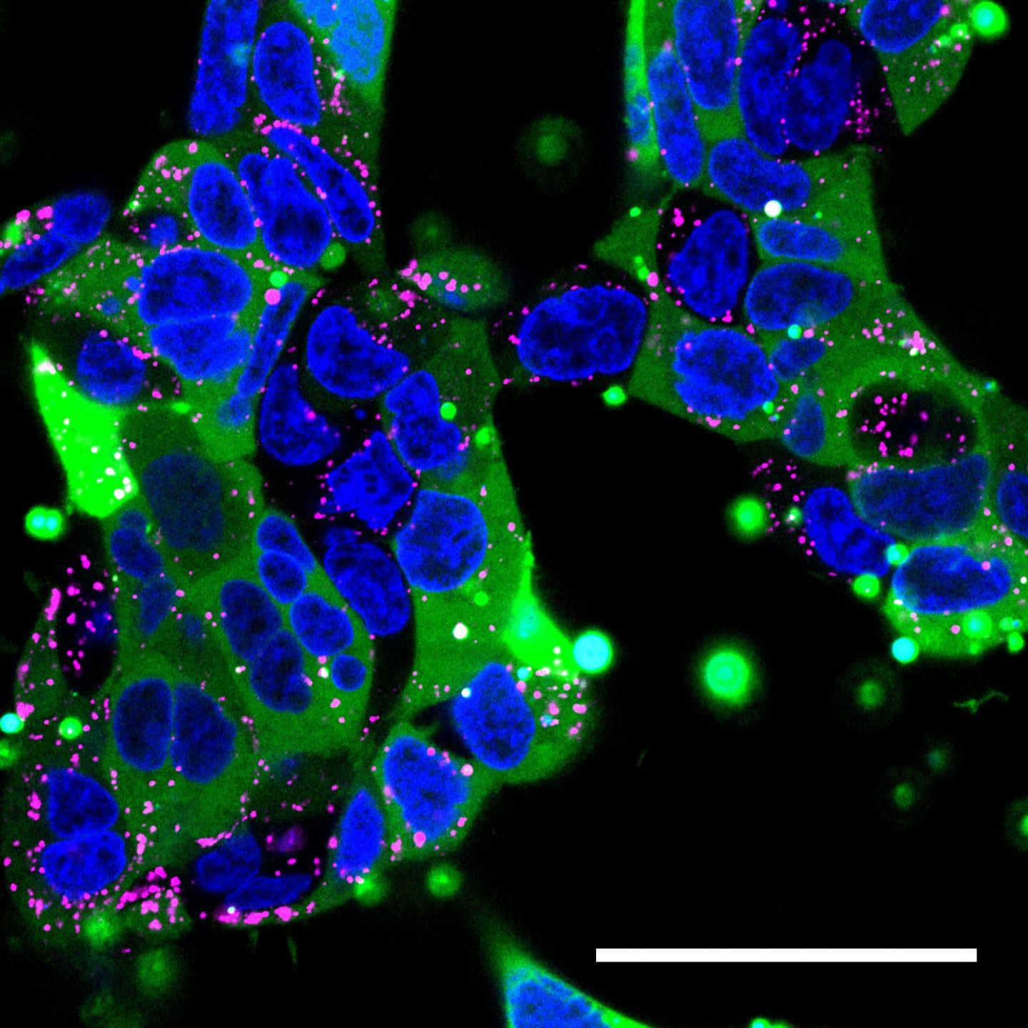 Confocal Microscopy