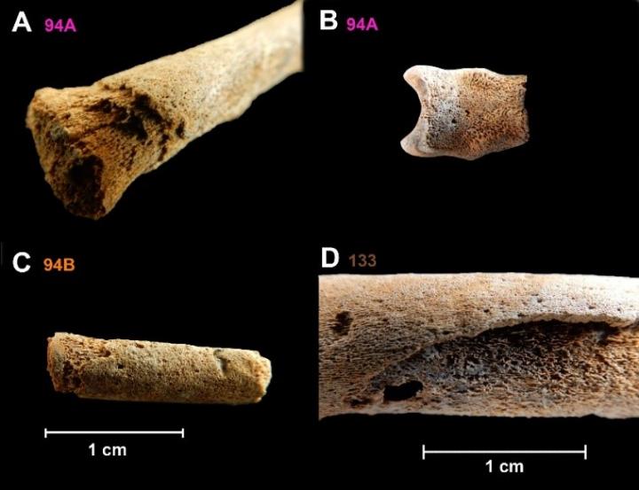 Ancient <i>Treponema pallidum</i> from Human Remains Sheds Light on Its Evolutionary History