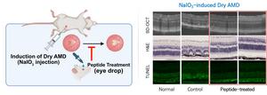 Therapeutic efficacy of the peptide in a mouse model of dry AMD.