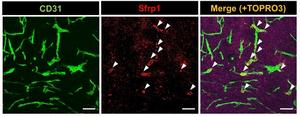 Tumor blood vessels produce the angiocrine factor, Sfrp1.