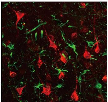 First Non-human primate study showing promise of gene therapy for stroke repair