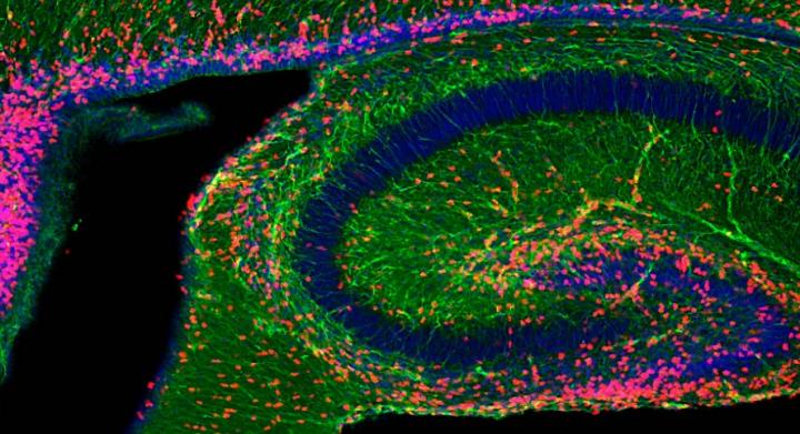 Exosome Bioactivity Illuminated