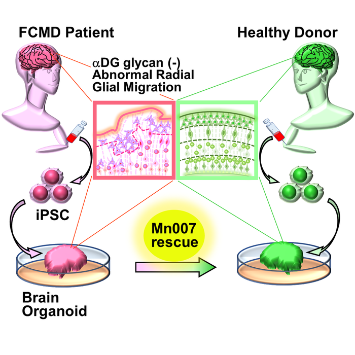 Rescue of FCMD-like defects in a brain organoid model developed using stem cells from patients with FCMD
