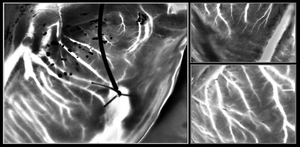 A powerful tool for imaging donor hearts, laser speckle captures detailed images of blood vessels in a beating heart outside the body.