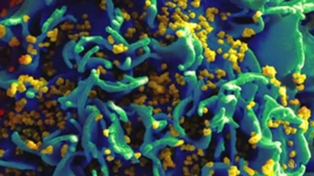 Editing HIV with CRISPR