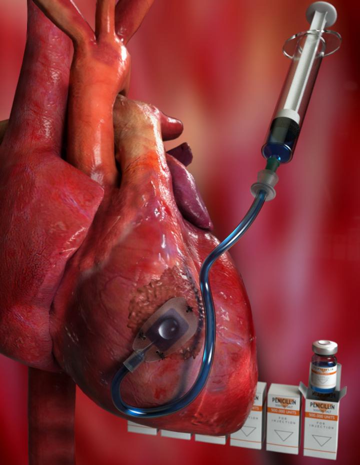 Illustration Therepi on a heart