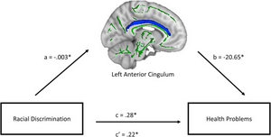 Racial discrimination affects brain microstructure