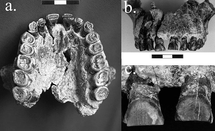 Teeth Striations in <i>Homo habilus</i> Fossil