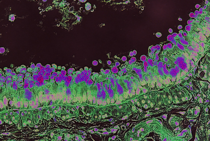 Color-enhanced goblet cells (dark purple) in lung epithelium