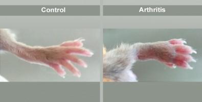 Tested in Mice with Genetically Induced Arthritis