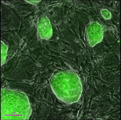 New Way to Make Reprogrammed Stem Cells