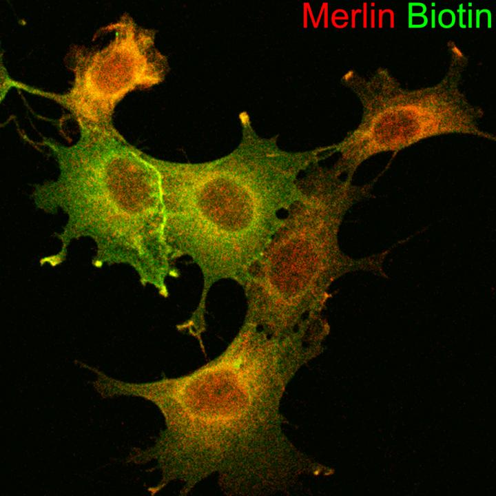 Shining a Light on the Rare Nerve Disease NF2