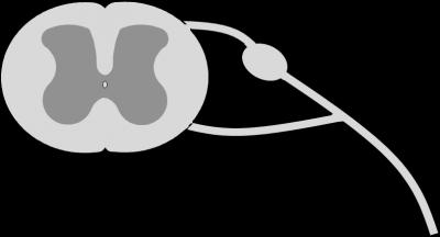 Immune Cell Releases Chemicals Which Activate Pain Neurons