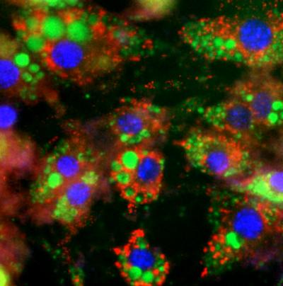 e-BAT, or engineered Brown Adipose Tissue