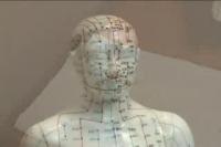 Acupuncture Can Prevent Radiation-Induced Chronic Dry Mouth