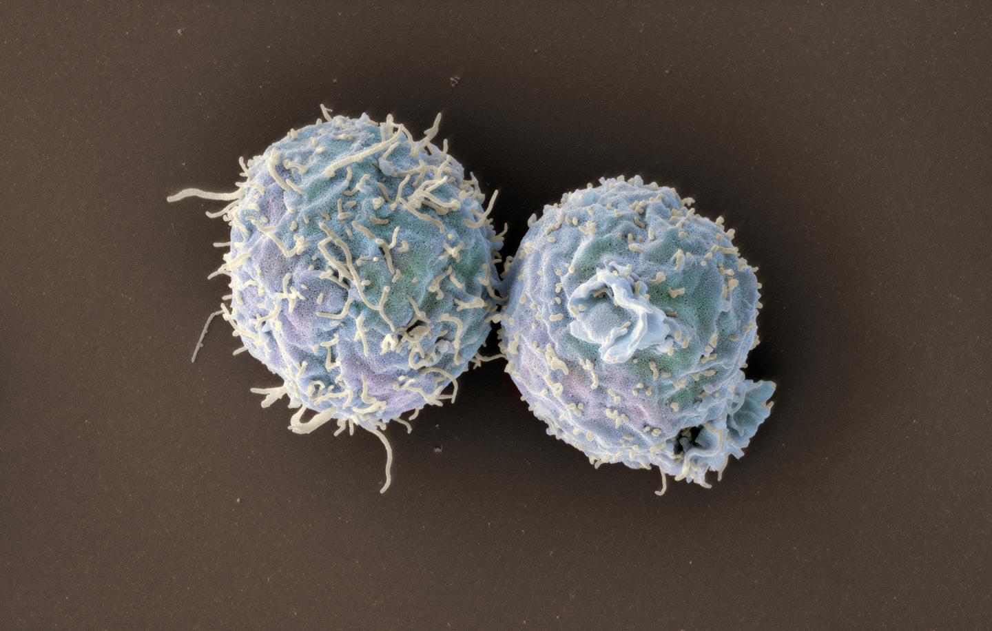 T Cells Lacking Coronin 1