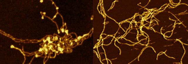 Images of 'Amyloid Fibrils'