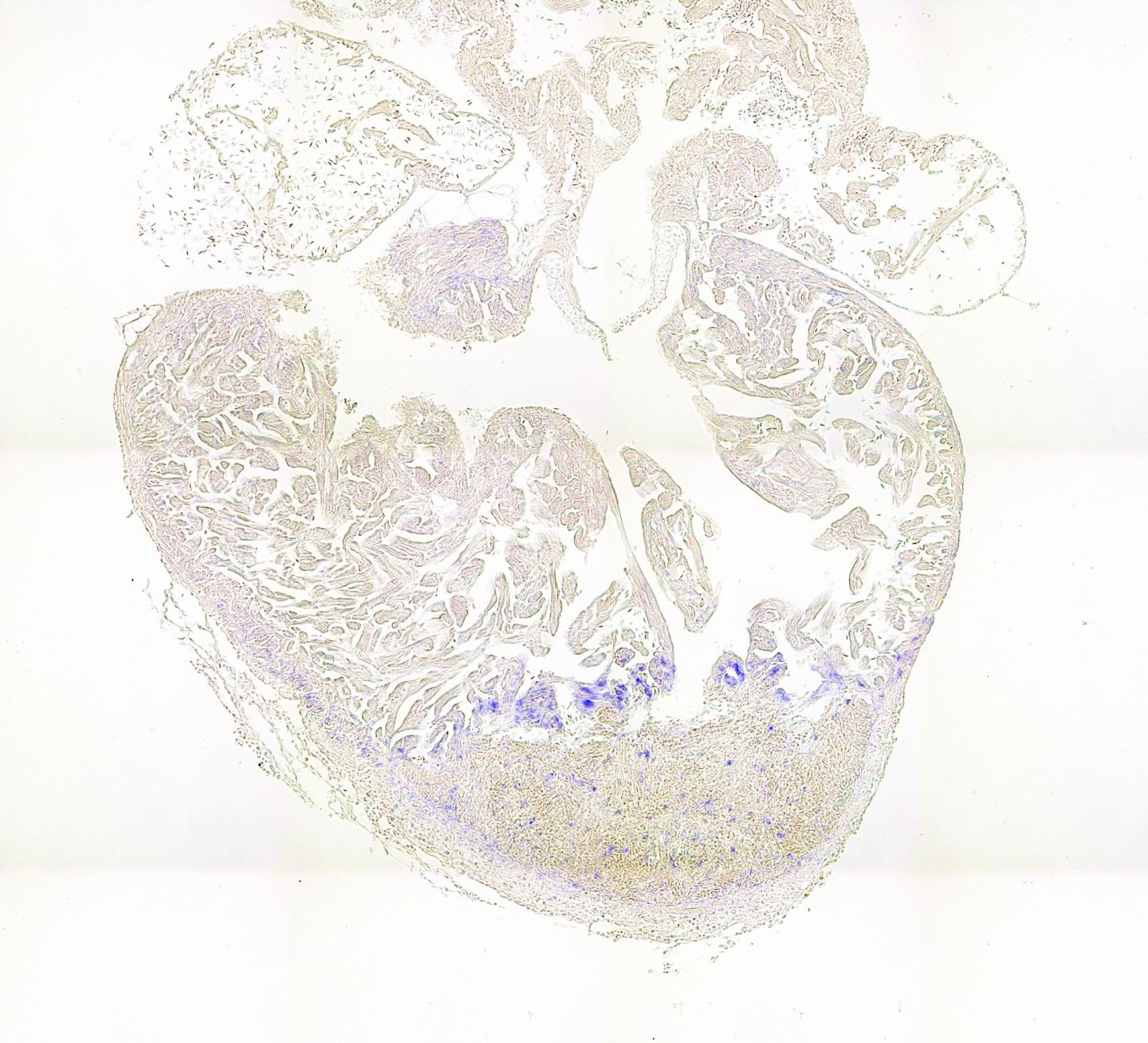 Activity of a Glycolysis Gene in the Border Zone of the Zebrafish Heart