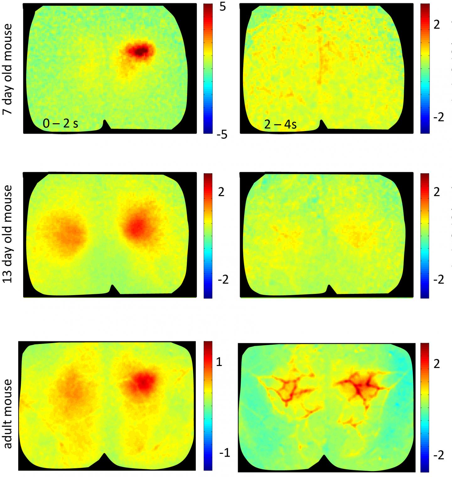 Neuronal Activity and Blood-Flow in the Growing Brain