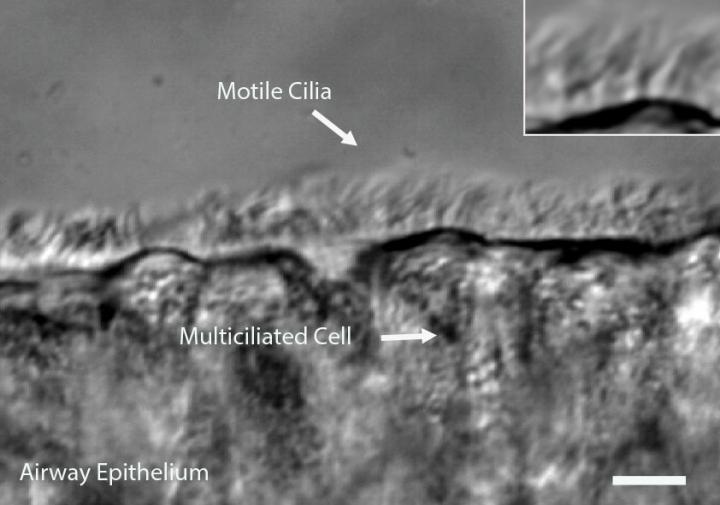 High-Resolution Imaging Toolbox Scopes Out Genetic Lung Disorder Using Hairy Cells (1 of 3)