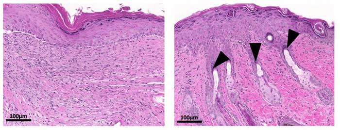 TGM promotes the regeneration of hair follicles after injuries