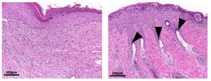 Intestinal parasite could be key to scarring