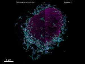 Multiview Confocal Super-Resolution Microscopy: fixed and expanded human cell