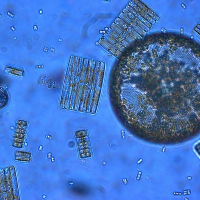 Phytoplankton from the Southern Ocean.