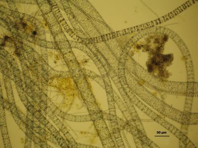 <i>Thioploca araucae</i>