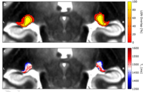 Fig.1