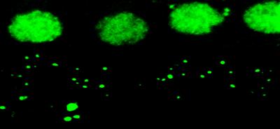 Genetic Predisposition for Noise-Induced Hearing Loss