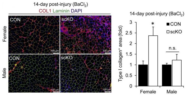 Muscle regeneration is impaired in female mice that specifically lack ERβ in muscle stem cells