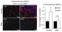 Muscle regeneration is impaired in female mice that specifically lack ER&#946; in muscle stem cells
