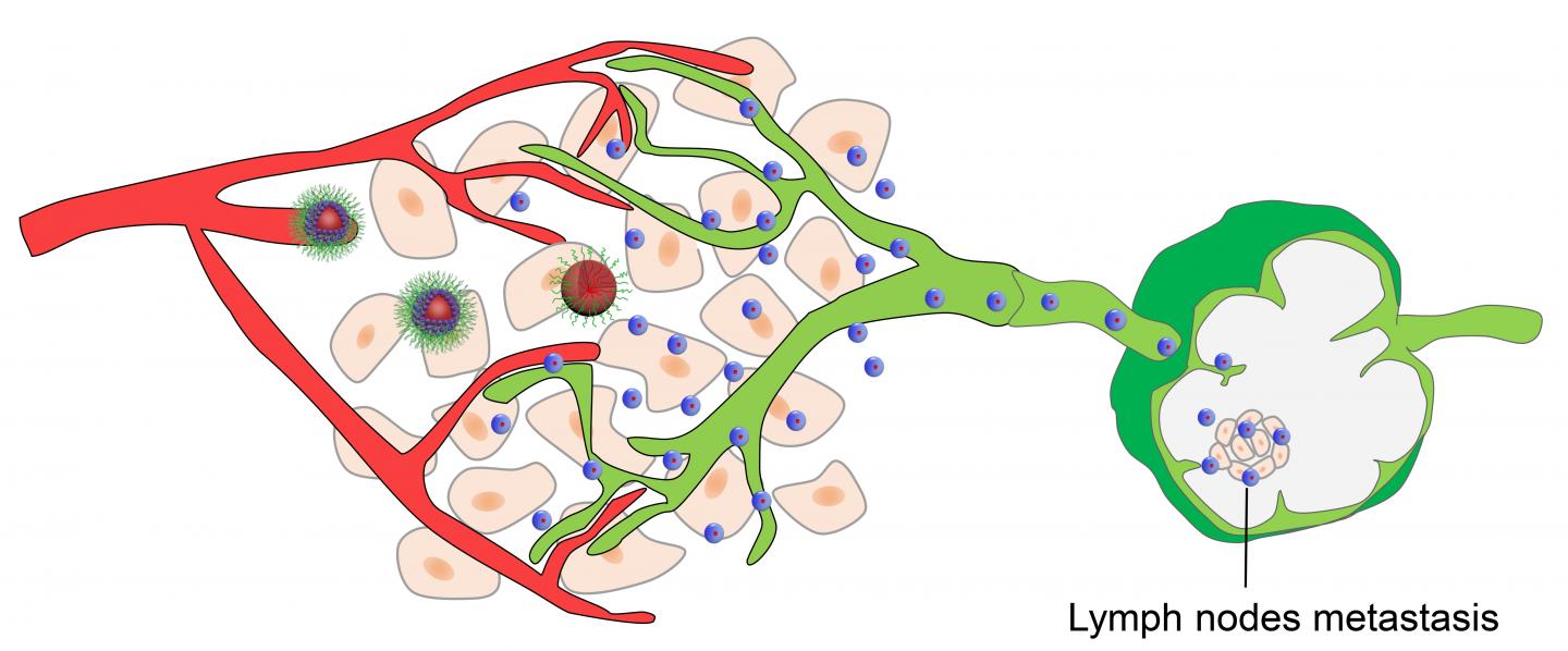 Nanoparticle Therapy Targets Lymph Node Metastases