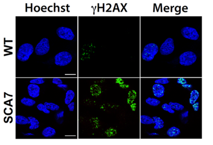 Increased DNA damage in neurons from SCA7 patients