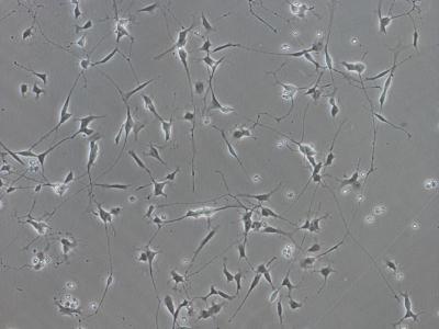 Nerve Cells Deficient in STIM1 (STIM1-KO)
