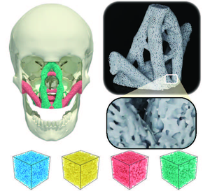 porous structures implants