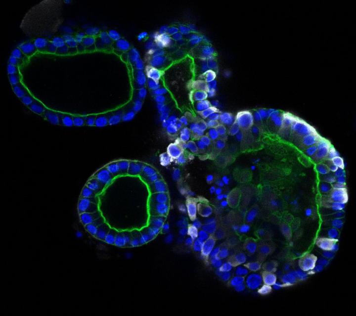 Intestinal organoids infected with coronavirus SARS-CoV-2