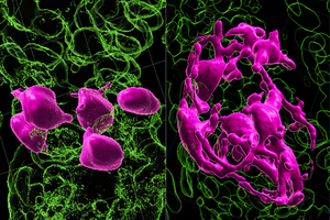 Melanocyte Stem Cells (McSCs)