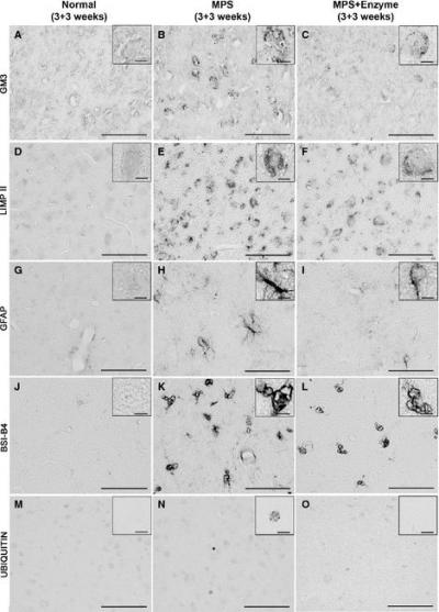 Lysosomal Storage Disorder