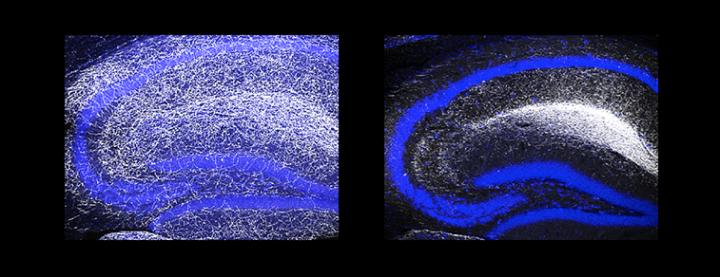 Serotonergic Neuron Distripution in Hippocampus
